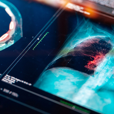 £400k fine after banksman crushed by a shovel loader on large waste and recycling site Image